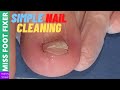 Simple Nail Cleaning |  Miss Foot Fixer | Marion Yau
