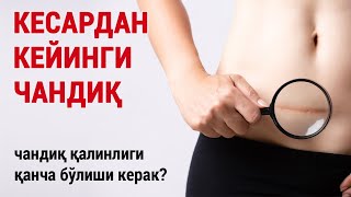 картинка: Кесардан кейинги чандиқ. Чандиқ қалинлиги қанча бўлиши керак?