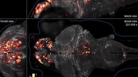 Time Lapse Zebrafish Neural Activity by Dr Phillip Keller