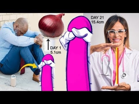 08 قد يجعلك البصل الأحمر والثوم بالعسل أسعد من أي وقت مضى