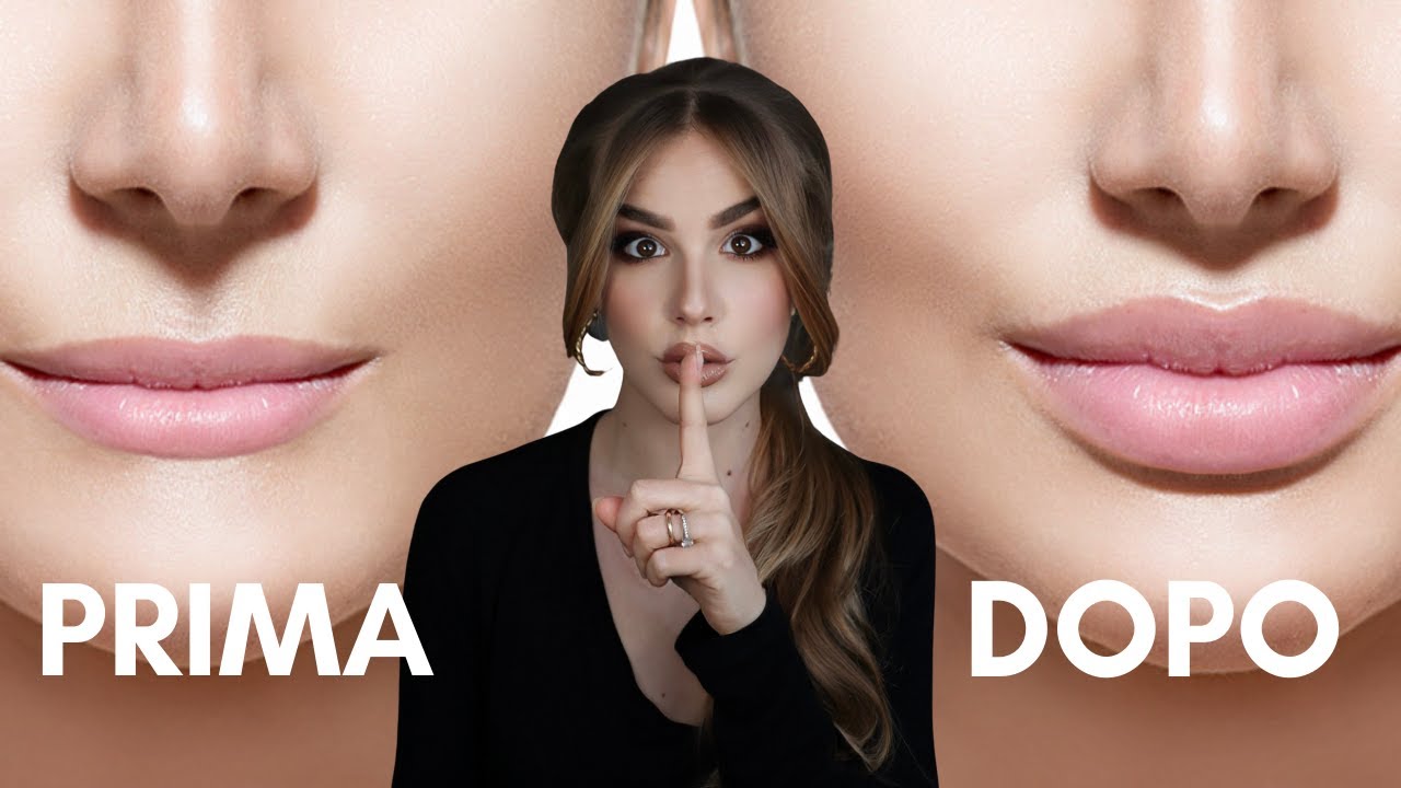 Volume labbra SENZA FILLER!