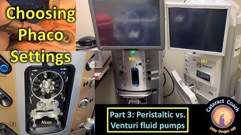 Phaco Fundamentals Part 3: Peristaltic vs Venturi Pumps in Cataract Surgery