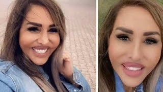 شاهد كيف اصبحت مها المصري بعد عمليات التجميل