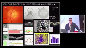 Angio-OCT in Glaucomas