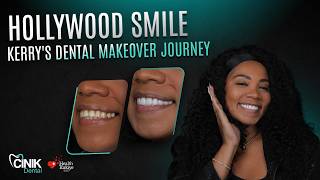 ✨Hollywood Smile Turkey: Smile Makeover Transformation #cinikdental #hollywoodsmileturkey