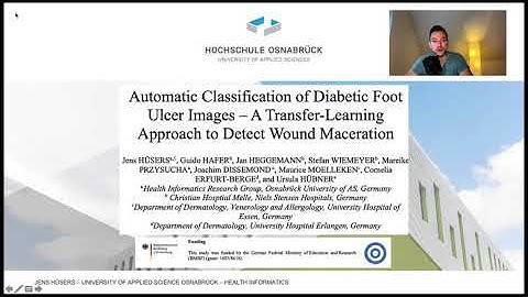 Automatic Classification of Diabetic Foot Ulcer Images – A Transfer-Learning Approach