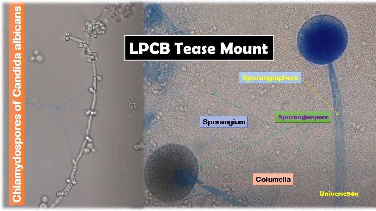 Mucor Species Colony Morphology On Sda And Lpcb Tease Mount Microscopy