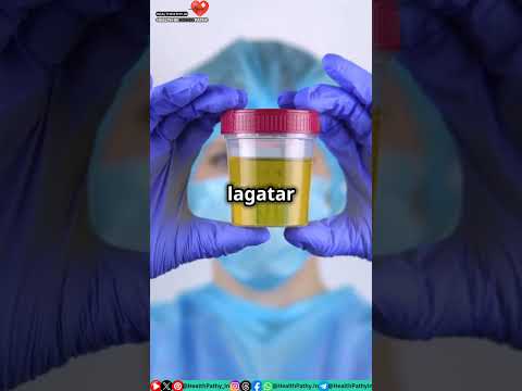 मूत्र में झाग क्यों जानिए कारण और उपाय! Urine Foam & Homeopathic Medicine