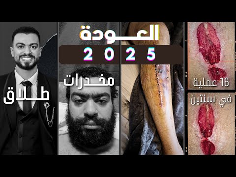 اختفيت ليه السنتين الى فاتو العوده