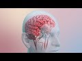 چه چیزی باعث سکته مغزی می شود چه چیزی باعث سکته مغزی می شود