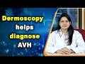 Dermoscopy helps diagnose avh