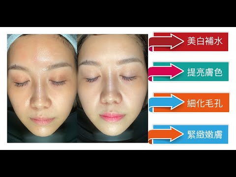 Dr.Pen逆齡美白提升療程