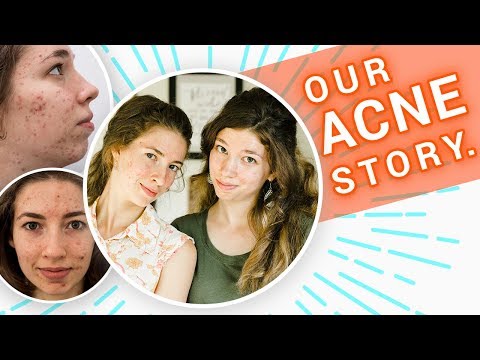 We STOPPED Using Acne Treatment that Worked 🙅  | The Boyer Sisters