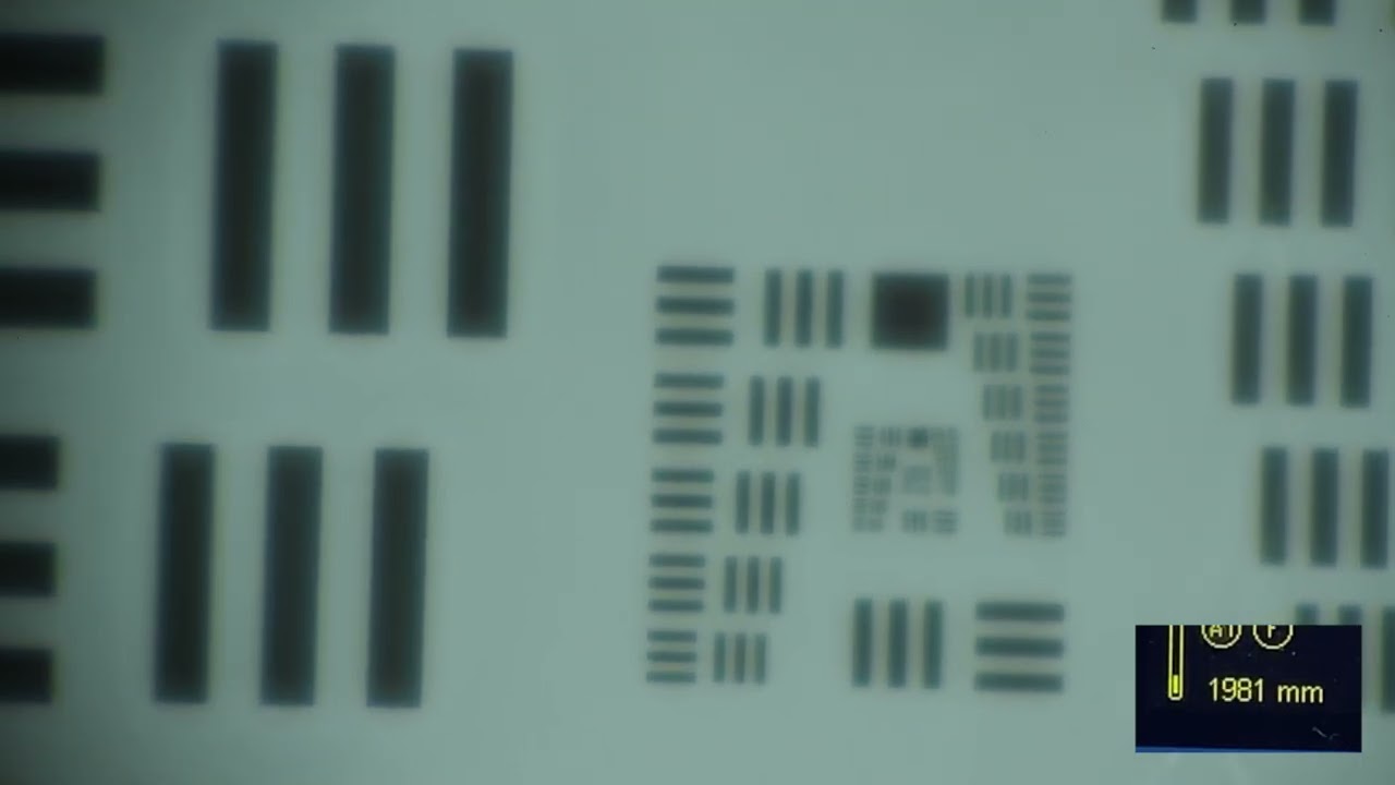 Synergy IOL 시너지 다초점인공수정체