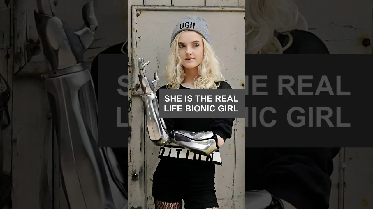 She is the real life bionic girl