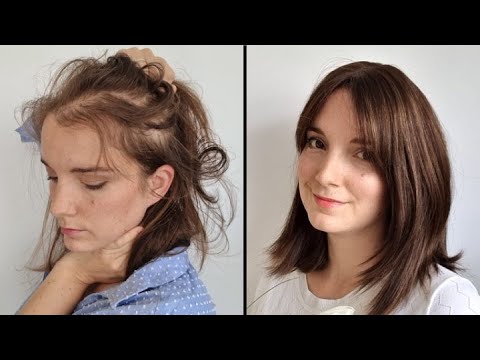 60 Alopecia hairstyles ideas  alopecia hairstyles alopecia hair styles