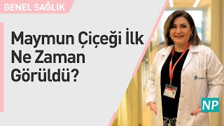 Maymun Çiçeği İlk Ne Zaman Görüldü?