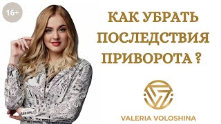 КАК УБРАТЬ ПОСЛЕДСТВИЯ ПРИВОРОТА?