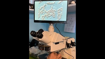 Live Blood Cells with DIC and Darkfield Dry Techniques w/63x Oil Apochromat / Zeiss Axioplan 2ie.