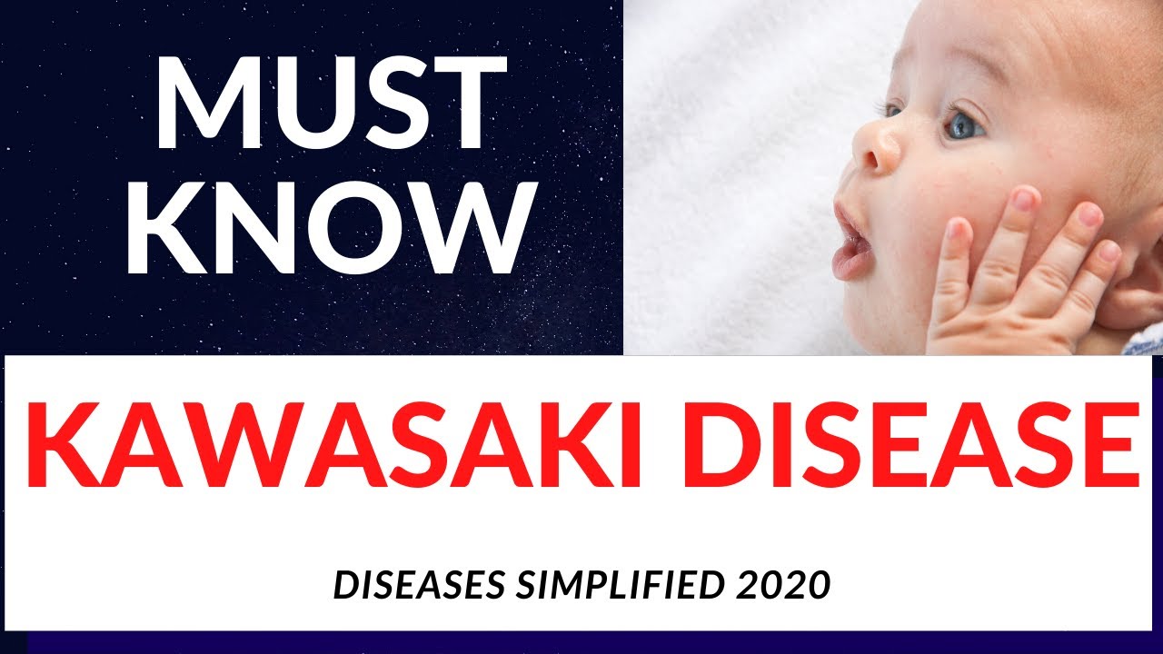 Must Know about KAWASAKI DISEASE YouTube
