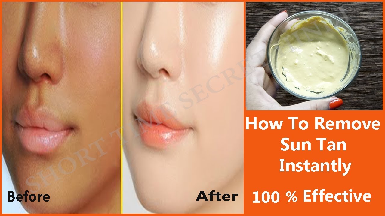 How To Remove Sun Tan Instantly 100 Effective And Natural Remedy