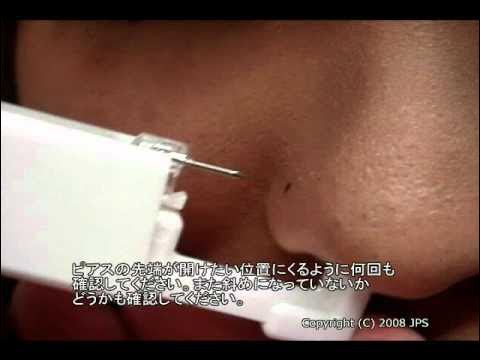 鼻のピアッシング-Nose piercing (Dr.Takahashi)