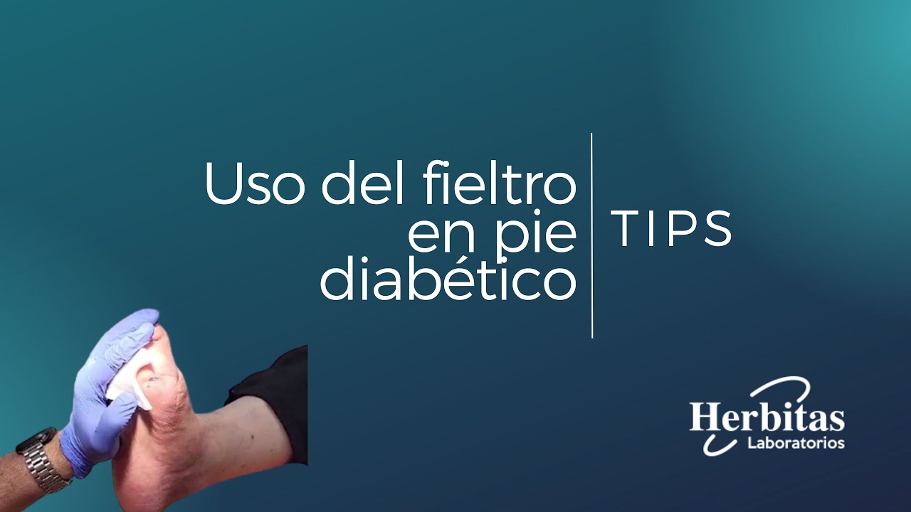 Fieltro adhesivo para descarga de pie diabético composición mixta -  Prevención Úlceras y Heridas tret e