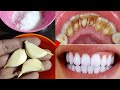 تبييض الاسنان في المنزل في دقيقتين || كيف تبيض أسنانك الصفراء بشكل طبيعي || فعالية 100٪