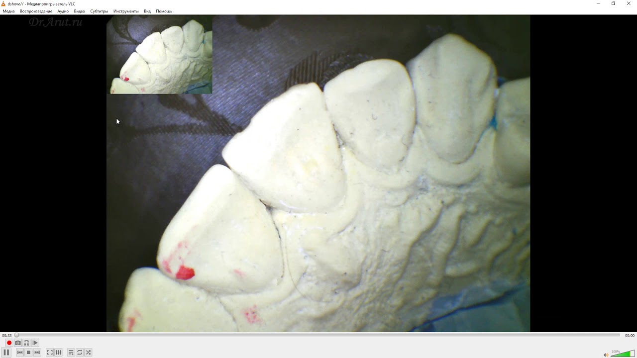 Использование VLC для работы с интраоральной камерой