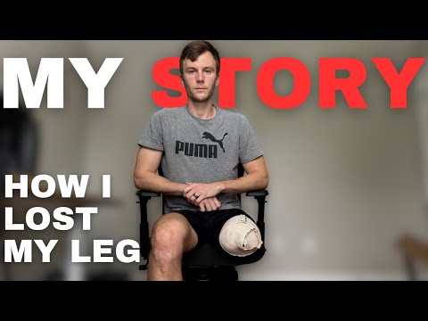 How I Lost My Leg - The Full Story Ep. 2
