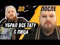 Убрал ТАТУ С ЛИЦА БЕЗ лазерного УДАЛЕНИЯ ! можно ли спрятать тату ТОНАЛКОЙ ?