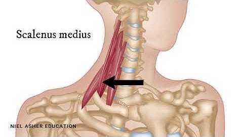 How To Find Trigger Points - Scalene Muscles