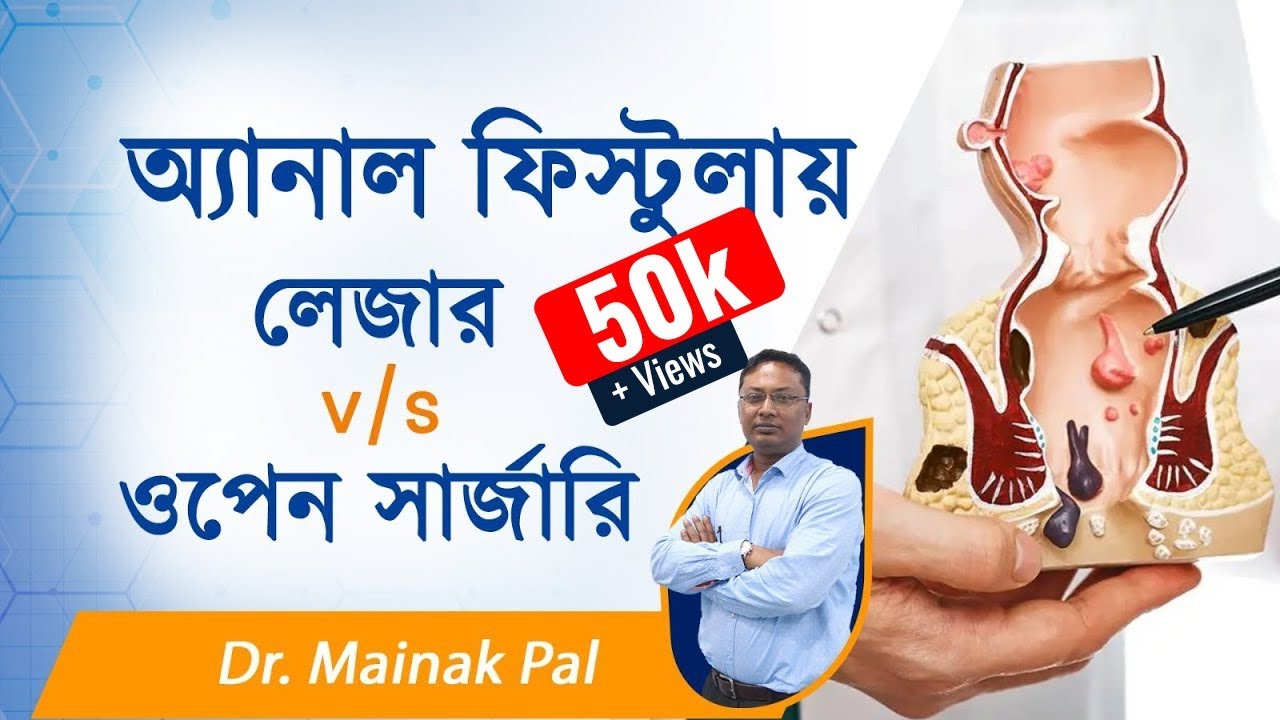 Anal Fistula | Laser Surgery or Open Surgery | Dactar Babu | Best Laparoscopic Surgeon in Kolkata
