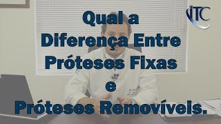 Qual a Diferença Entre Prótese Removível e Prótese Fixa - Dr. Thiago Cabral - Porto Alegre