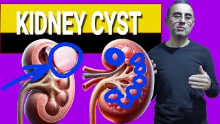 Kidney Cysts: When to Worry and When to Relax?!