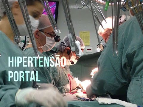 Técnica exclusiva para tratamento de hipertensão portal