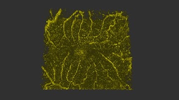 Volume Rendering of Type 3 Macular Neovascularization from OCT Angiography