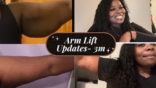 3 MONTHS POST-OP ARM LIFT RECOVERY TIPS/ SCAR UPDATE PT.1