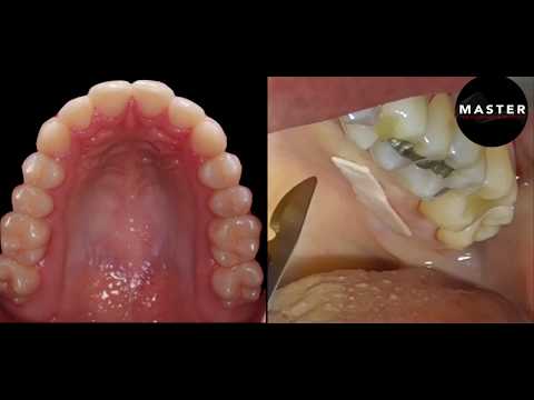 Vídeo: Quadro Jurídico E ético Para A Informação Global Em Saúde E O Intercâmbio De Bio-espécimes - Uma Perspectiva Internacional