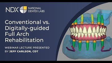 Conventional vs. Digitally-guided Full Arch Rehabilitation