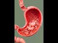 Stomach Irritation