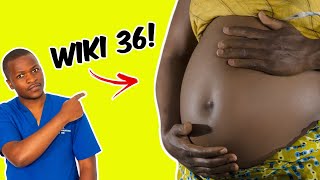 Kujifungua Wiki Ya 36 NA Madhara Yake 9!