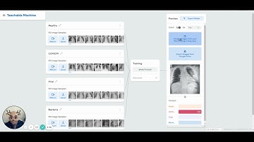 WeirdBaby: Lung Disease Detection using Artificial Intelligence