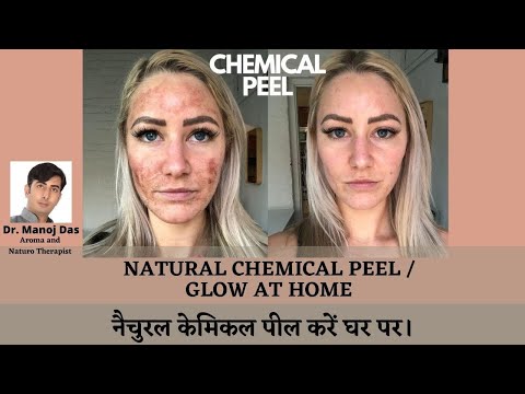 NATURAL CHEMICAL PEEL / GLOW AT HOME I नैचुरल केमिकल पील करें घर पर।  Dr. Manoj Das