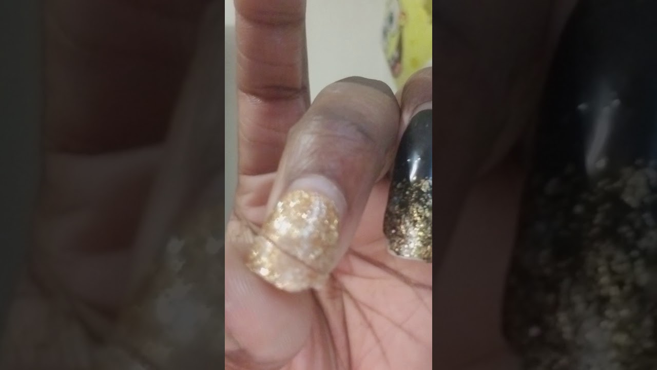 Emergency nail  fixing