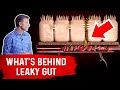 What's Really Behind Leaky Gut? – Dr.Berg On Leaky Gut Symptoms  & Vitamin C Deficiency