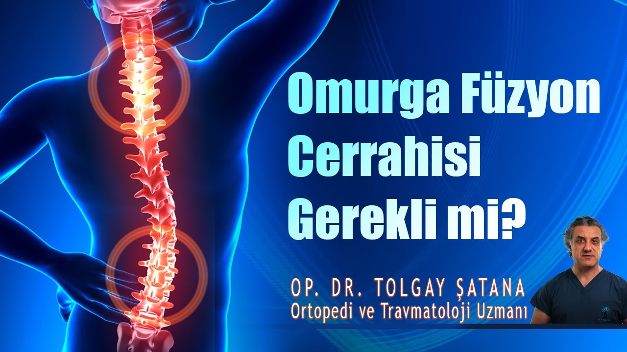 Omurga Füzyon Cerrahisi Gerekli mi?