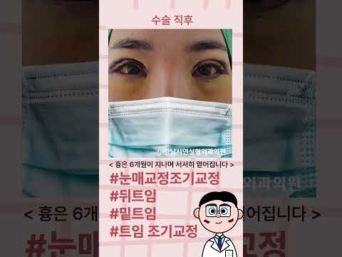 타병원 수술 실패 후 고통받던 환자분, 조기교정 이야기