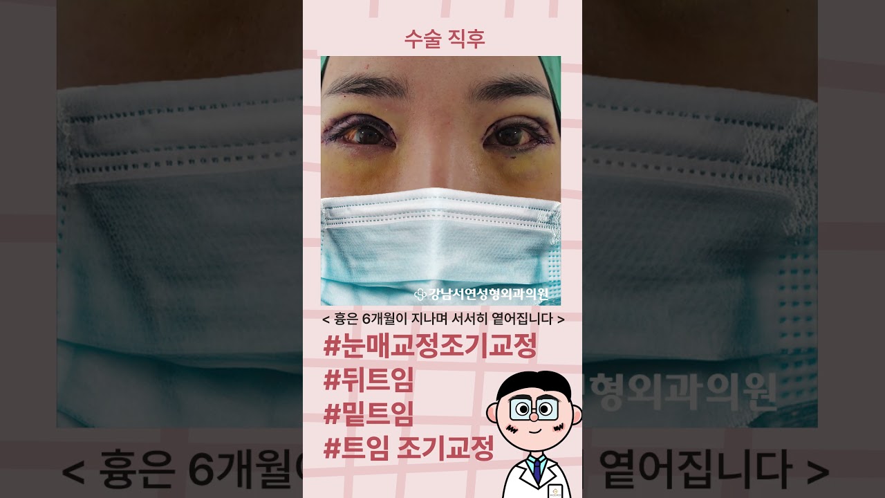 [Ганнам Соён гоо сайхны мэс заслын эмнэлэг] Бусад эмнэлэгт хийсэн мэс засал амжилтгүй болсноос шаналж байсан өвчтөнийг эрт засварласан түүх.