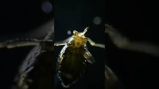 Aphid under the #microscope #greenfly #blackfly #aphids Aphid under the #microscope #greenfly #blackfly #aphids